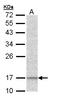 NADH:Ubiquinone Oxidoreductase Subunit A12 antibody, LS-C186079, Lifespan Biosciences, Western Blot image 