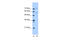 Junctophilin 1 antibody, 30-528, ProSci, Western Blot image 