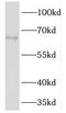 Transmembrane 7 Superfamily Member 3 antibody, FNab08732, FineTest, Western Blot image 