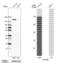 Pleckstrin Homology Like Domain Family B Member 2 antibody, PA5-57176, Invitrogen Antibodies, Western Blot image 