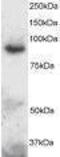 ADAM Metallopeptidase Domain 8 antibody, PA1-31538, Invitrogen Antibodies, Western Blot image 