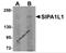 Signal-induced proliferation-associated 1-like protein 1 antibody, 5491, ProSci, Western Blot image 