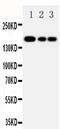 ATP Binding Cassette Subfamily C Member 1 antibody, PA5-78694, Invitrogen Antibodies, Western Blot image 