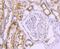 Solute Carrier Family 2 Member 2 antibody, NBP2-67860, Novus Biologicals, Immunohistochemistry paraffin image 