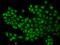 Transcription Factor 4 antibody, 200207-T02, Sino Biological, Immunohistochemistry paraffin image 