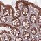 Multiple C2 And Transmembrane Domain Containing 2 antibody, NBP2-33607, Novus Biologicals, Immunohistochemistry paraffin image 