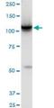 Hexokinase 2 antibody, H00003099-M01, Novus Biologicals, Western Blot image 