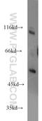 Receptor Interacting Serine/Threonine Kinase 2 antibody, 15366-1-AP, Proteintech Group, Western Blot image 