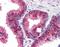 Baculoviral IAP Repeat Containing 2 antibody, orb86537, Biorbyt, Immunohistochemistry paraffin image 