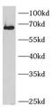 SMAD Family Member 4 antibody, FNab07995, FineTest, Western Blot image 