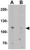 Calcium-transporting ATPase type 2C member 2 antibody, GTX32009, GeneTex, Western Blot image 