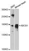 ATP Binding Cassette Subfamily B Member 1 antibody, LS-C747122, Lifespan Biosciences, Western Blot image 