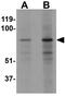 Enhancer Of Zeste 1 Polycomb Repressive Complex 2 Subunit antibody, GTX31434, GeneTex, Western Blot image 
