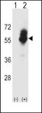 CTR1 antibody, LS-C161270, Lifespan Biosciences, Western Blot image 