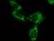 Ubiquitin B antibody, BML-PW1225-0025, Enzo Life Sciences, Immunofluorescence image 