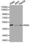 Renin antibody, A03689-1, Boster Biological Technology, Western Blot image 