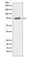 Bruton Tyrosine Kinase antibody, P00245, Boster Biological Technology, Western Blot image 