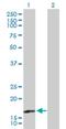 Trafficking Protein Particle Complex 3 antibody, H00027095-B01P, Novus Biologicals, Western Blot image 