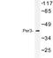 Period Circadian Regulator 3 antibody, LS-C176917, Lifespan Biosciences, Western Blot image 