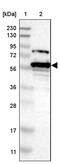 Spastin antibody, PA5-53581, Invitrogen Antibodies, Western Blot image 