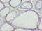 Gasdermin C antibody, LS-C398597, Lifespan Biosciences, Immunohistochemistry paraffin image 