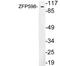 Zinc Finger Protein 598 antibody, LS-C200057, Lifespan Biosciences, Western Blot image 