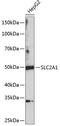 Solute Carrier Family 2 Member 1 antibody, GTX66071, GeneTex, Western Blot image 