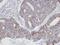 Actin Related Protein 2/3 Complex Subunit 3 antibody, orb556005, Biorbyt, Immunohistochemistry frozen image 