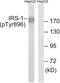 Insulin Receptor Substrate 1 antibody, A00268Y896, Boster Biological Technology, Western Blot image 