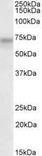 PRK antibody, LS-B10518, Lifespan Biosciences, Western Blot image 