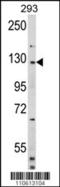 Dishevelled Associated Activator Of Morphogenesis 2 antibody, 63-022, ProSci, Western Blot image 