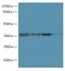 Programmed Cell Death 1 antibody, LS-C377503, Lifespan Biosciences, Western Blot image 