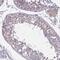 Transcription Elongation Factor A Like 8 antibody, PA5-63658, Invitrogen Antibodies, Immunohistochemistry paraffin image 