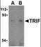 Toll Like Receptor Adaptor Molecule 1 antibody, MBS395645, MyBioSource, Western Blot image 