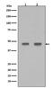 Pancreas/duodenum homeobox protein 1 antibody, M00491, Boster Biological Technology, Western Blot image 