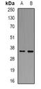 Linker For Activation Of T Cells antibody, orb338972, Biorbyt, Western Blot image 