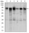 Transforming Growth Factor Beta Receptor 3 antibody, GTX60683, GeneTex, Western Blot image 