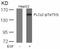 Phospholipase C-gamma-2 antibody, GTX50225, GeneTex, Western Blot image 