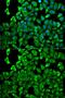 Proteasome 26S Subunit, Non-ATPase 2 antibody, GTX33439, GeneTex, Immunocytochemistry image 