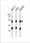 Cathepsin D antibody, TA324903, Origene, Western Blot image 