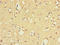 Exonuclease 1 antibody, LS-C395800, Lifespan Biosciences, Immunohistochemistry paraffin image 