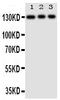 Toll Like Receptor 10 antibody, PA1958, Boster Biological Technology, Western Blot image 