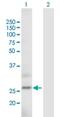 Actin Related Protein 2/3 Complex Subunit 5 Like antibody, H00081873-B02P, Novus Biologicals, Western Blot image 