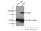 Transglutaminase 2 antibody, 15100-1-AP, Proteintech Group, Immunoprecipitation image 