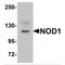 Nucleotide-binding oligomerization domain-containing protein 1 antibody, TA349016, Origene, Western Blot image 