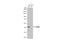 Ribonucleotide Reductase Regulatory Subunit M2 antibody, GTX636634, GeneTex, Western Blot image 