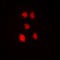 Zinc Finger Protein 148 antibody, LS-C358401, Lifespan Biosciences, Immunofluorescence image 