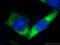 RAB5B, Member RAS Oncogene Family antibody, 27403-1-AP, Proteintech Group, Immunofluorescence image 