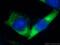 Ras-related protein Rab-5B antibody, 27403-1-AP, Proteintech Group, Immunofluorescence image 