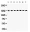 Discs Large MAGUK Scaffold Protein 1 antibody, PB9552, Boster Biological Technology, Western Blot image 